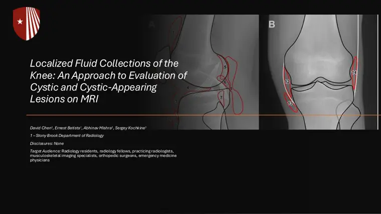 Cover of Localized Fluid Collections of the Knee: An Approach to Evaluation of Cystic and Cystic-Appearing Lesions on MRI