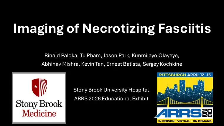 Cover of Imaging of Necrotizing Fasciitis
